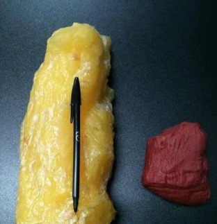 Fat vs muscle